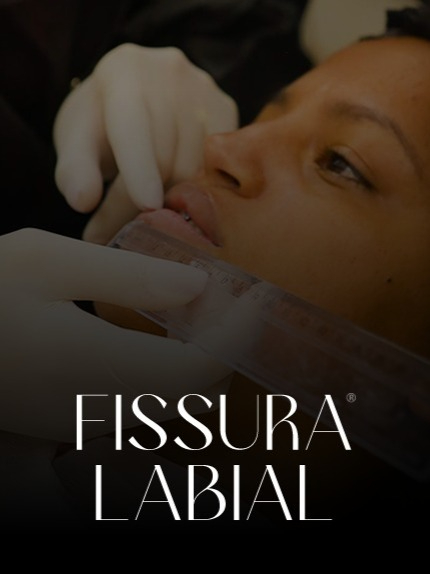 Treinamento Fissura Labial